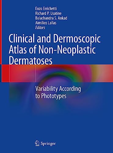 Clinical and Dermoscopic Atlas of Non-Neoplastic Dermatoses: Variability According to Phototypes (English Edition)