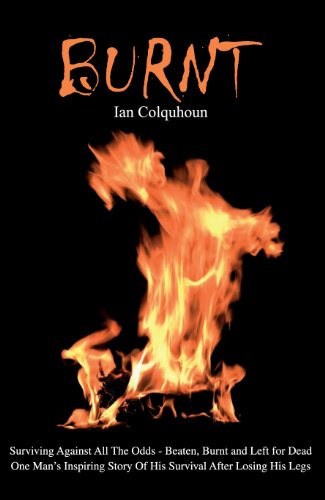 Burnt: Surviving Against all the Odds – Beaten, Burnt and Left for Dead. One Man’s Inspiring Story of His Survival After Losing His Legs (English Edition)