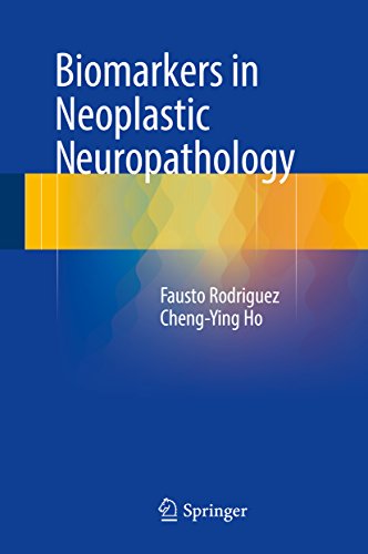 Biomarkers in Neoplastic Neuropathology (English Edition)