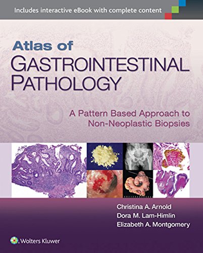Atlas of Gastrointestinal Pathology: A Pattern Based Approach to Non-Neoplastic Biopsies (English Edition)