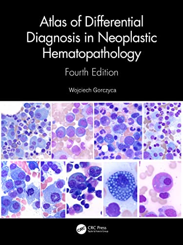 Atlas of Differential Diagnosis in Neoplastic Hematopathology (English Edition)