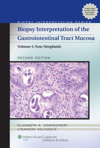 Biopsy Interpretation of the Gastrointestinal Tract Mucosa: Volume 1: Non-Neoplastic (Biopsy Interpretation Series) (English Edition)