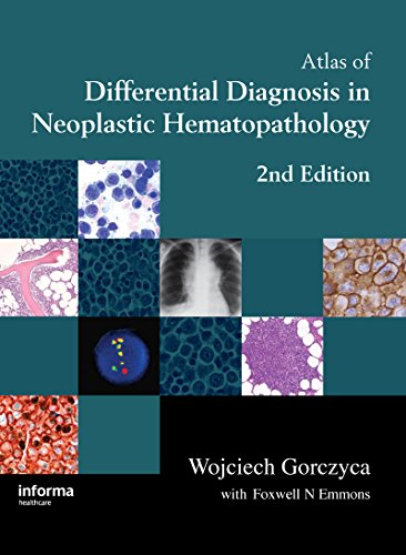 Atlas of Differential Diagnosis in Neoplastic Hematopathology (English Edition)