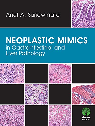Neoplastic Mimics in Gastrointestinal and Liver Pathology (Pathology of Neoplastic Mimics) (English Edition)