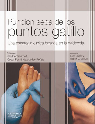 Punción seca de los puntos gatillo: Una estrategia clínica basada en la evidencia