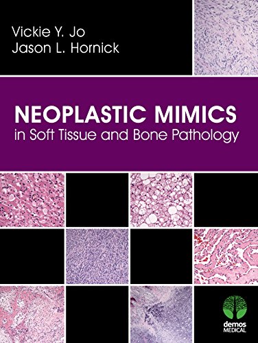 Neoplastic Mimics in Soft Tissue and Bone Pathology (Pathology of Neoplastic Mimics) (English Edition)