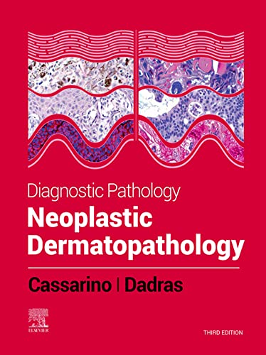 Diagnostic Pathology: Neoplastic Dermatopathology: Diagnostic Pathology: Neoplastic Dermatopathology E-Book (English Edition)