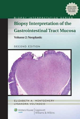 Biopsy Interpretation of the Gastrointestinal Tract Mucosa: Volume 2: Neoplastic (Biopsy Interpretation Series) (English Edition)