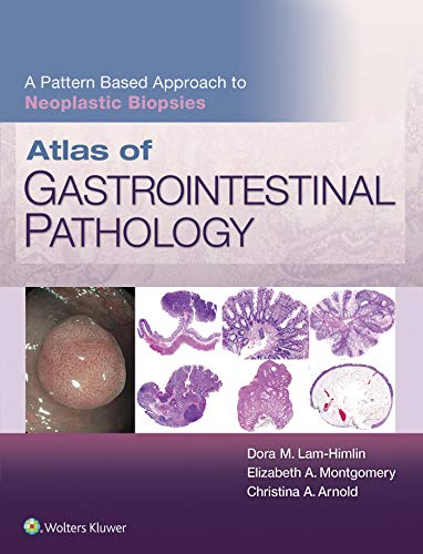 Atlas of Gastrointestinal Pathology: A Pattern Based Approach to Neoplastic Biopsies (English Edition)