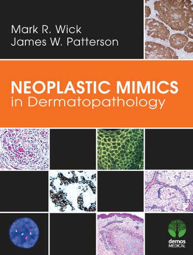 Neoplastic Mimics in Dermatopathology (Pathology of Neoplastic Mimics) (English Edition)