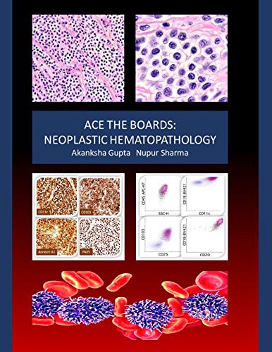 Ace the Boards: Neoplastic Hematopathology (Ace My Path) (English Edition)