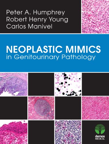 Neoplastic Mimics in Genitourinary Pathology (Pathology of Neoplastic Mimics) (English Edition)