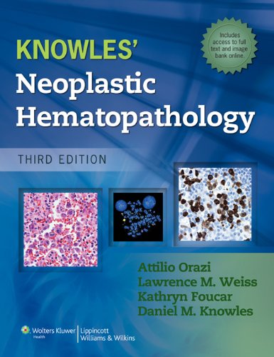 Knowles Neoplastic Hematopathology (English Edition)
