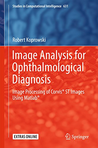 Image Analysis for Ophthalmological Diagnosis: Image Processing of Corvis® ST Images Using Matlab® (Studies in Computational Intelligence Book 631) (English Edition)
