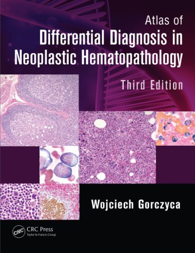 Atlas of Differential Diagnosis in Neoplastic Hematopathology (English Edition)