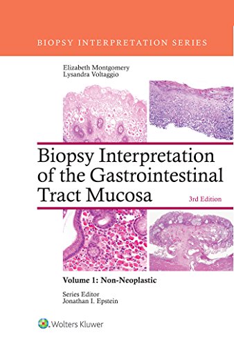 Biopsy Interpretation of the Gastrointestinal Tract Mucosa: Volume 1: Non-Neoplastic (Biopsy Interpretation Series) (English Edition)