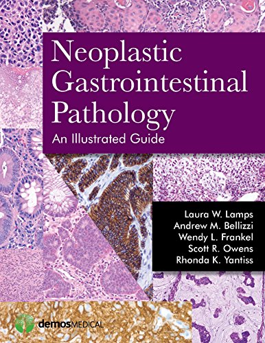 Neoplastic Gastrointestinal Pathology: An Illustrated Guide (English Edition)